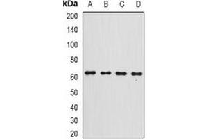 Western blot analysis of Gc-globulin expression in A549 (A), A375 (B), SHSY5Y (C), mouse liver (D) whole cell lysates. (Vitamin D-Binding Protein anticorps)