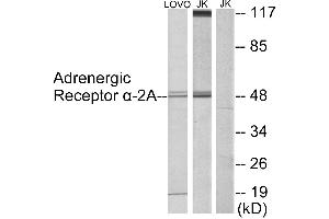 Immunohistochemistry analysis of paraffin-embedded human testis tissue using Adrenergic Receptor α-2A antibody. (ADRA2A anticorps  (Internal Region))