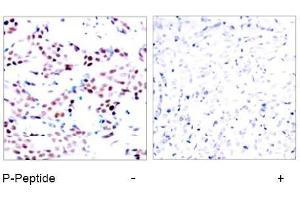 Image no. 2 for anti-Jun Proto-Oncogene (JUN) (pThr91) antibody (ABIN196647) (C-JUN anticorps  (pThr91))