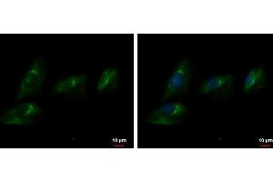 anti-Ectonucleotide Pyrophosphatase / phosphodiesterase 2 (ENPP2) (C-Term) antibody
