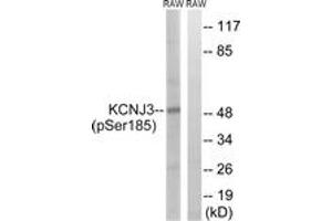 Western blot analysis of extracts from RAW264. (KCNJ3 anticorps  (pSer185))