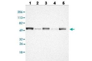 Western blot analysis of Lane 1: RT-4 cell line, Lane 2: U-251MG sp cell line, Lane 3: A-431 cell line, Lane 4: human liver tissue, and Lane 5: human tonsil tissue with LYN polyclonal antibody . (LYN anticorps  (AA 7-147))