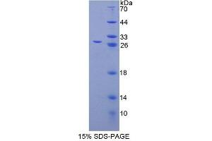 SDS-PAGE (SDS) image for Calcium Modulating Ligand (CAMLG) (AA 19-184) protein (His tag) (ABIN6238953)