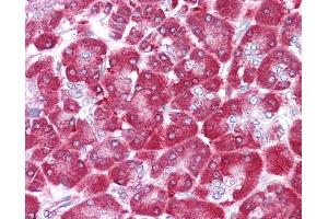 NME1 antibody was used for immunohistochemistry at a concentration of 4-8 ug/ml.