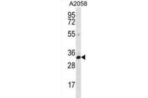 Western Blotting (WB) image for anti-Calponin 2 (CNN2) antibody (ABIN2996730) (CNN2 anticorps)