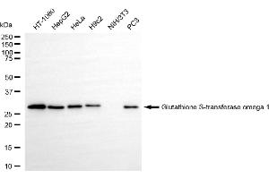 Western blotting analysis using glutathione S-transferase omega 1 antibody (ABIN7798757).