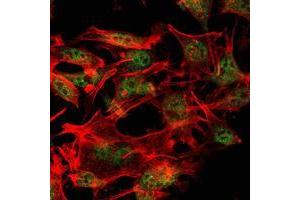 Immunofluorescence analysis of LOVO cells using SETDB1 mouse mAb (green). (SETDB1 anticorps)