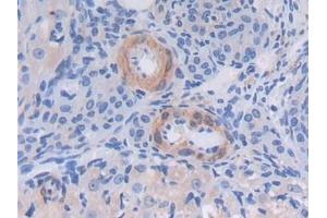 Detection of TXNIP in Mouse Ovary Tissue using Polyclonal Antibody to Thioredoxin-interacting Protein (TXNIP)