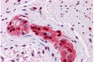 Human Colon, myenteric plexus: Formalin-Fixed, Paraffin-Embedded (FFPE)