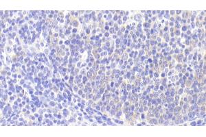 Detection of PIK3Cb in Human Lymph node Tissue using Polyclonal Antibody to Phosphoinositide-3-Kinase Catalytic Beta Polypeptide (PIK3Cb)