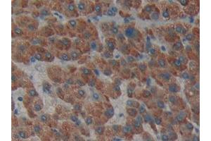 Used in DAB staining on fromalin fixed paraffin- embedded liver tissue (Laminin alpha 1 anticorps  (AA 2613-2746))