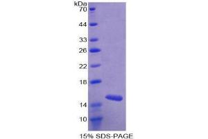 SDS-PAGE (SDS) image for Mucosae Associated Epithelia Chemokine (AA 20-115) protein (His tag) (ABIN2125970)