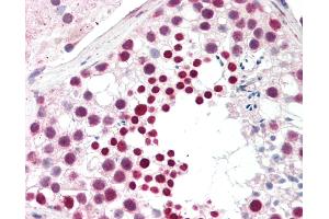 anti-Cancer/testis Antigen 1B (CTAG1B) (C-Term) antibody