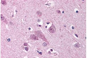 Human Brain, Cortex (formalin-fixed, paraffin-embedded) stained with MARK1 antibody ABIN239803 at 2.