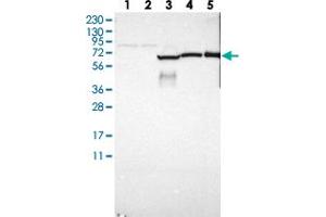 Western blot analysis of Lane 1: RT-4, Lane 2: U-251 MG, Lane 3: Human Plasma, Lane 4: Liver, Lane 5: Tonsil with GAB3 polyclonal antibody .