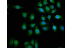 Immunofluorescence staining of A549 cells with ABIN7160149 at 1:133, counter-stained with DAPI. (ABHD6 anticorps  (AA 105-211))