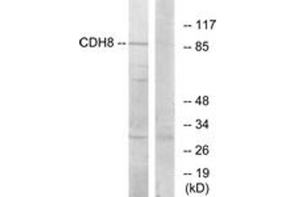 Cadherin 8 anticorps  (AA 491-540)