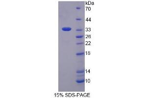 SDS-PAGE (SDS) image for Single-Strand-Selective Monofunctional Uracil-DNA Glycosylase 1 (SMUG1) (AA 1-270) protein (His tag) (ABIN4990671) (SMUG1 Protein (AA 1-270) (His tag))
