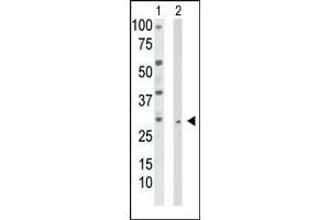 The anti-TK2 Pab (ABIN1882141 and ABIN2841224) is used in Western blot to detect TK2 in HepG2 cell lysate (Lane 1) and mouse liver tissue lysate (Lane 2).