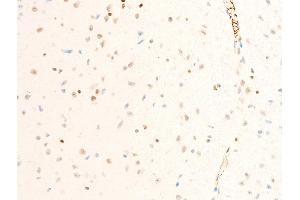 ABIN6267302 at 1/100 staining mouse brain tissue sections by IHC-P.