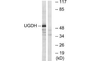 Western blot analysis of extracts from COLO cells, using UGDH antibody. (UGDH anticorps  (C-Term))