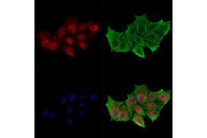 Phospho-Lamin A/C (Ser22) Antibody staining HepG2 cells(serum starvation treatment) by IF/ICC.