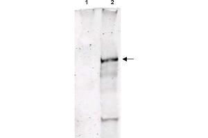 Image no. 1 for anti-Ataxia Telangiectasia Mutated (ATM) (pSer1981) antibody (ABIN401482) (ATM anticorps  (pSer1981))