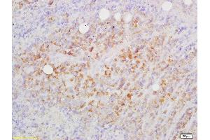 Formalin-fixed and paraffin embedded mouse lymphoma labeled with Rabbit Anti-CD82/KAI1 Polyclonal Antibody, Unconjugated  at 1:200 followed by conjugation to the secondary antibody and DAB staining (CD82 anticorps  (AA 165-267))