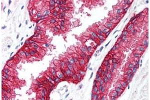 Immunohistochemistry (Formalin/PFA-fixed paraffin-embedded sections) of human prostate tissue with KCNN4 polyclonal antibody . (KCNN4 anticorps  (C-Term))