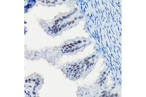 Immunohistochemistry of paraffin-embedded rat fallopian tube using Progesterone Receptor Rabbit pAb (ABIN6128570, ABIN6145518, ABIN6145519 and ABIN6213802) at dilution of 1:100 (40x lens). (Progesterone Receptor anticorps  (AA 1-250))