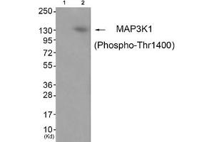 Western blot analysis of extracts from JK cells (Lane 2), using MAP3K1 (Phospho-Thr1400) Antibody.