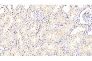 Detection of ROR1 in Human Kidney Tissue using Polyclonal Antibody to Receptor Tyrosine Kinase Like Orphan Receptor 1 (ROR1)