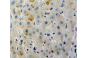 Used in DAB staining on fromalin fixed paraffin-embedded Liver tissue