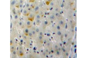 Used in DAB staining on fromalin fixed paraffin-embedded Liver tissue (CD79b anticorps  (AA 37-226))