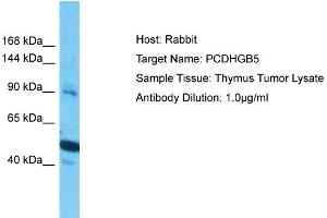 Host: Rabbit Target Name: PCDHGB5 Sample Type: Thymus Tumor lysates Antibody Dilution: 1. (PCDHGB5 anticorps  (Middle Region))