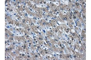 Immunohistochemistry (IHC) image for anti-Aldo-Keto Reductase Family 1, Member A1 (Aldehyde Reductase) (AKR1A1) antibody (ABIN1496544) (AKR1A1 anticorps)