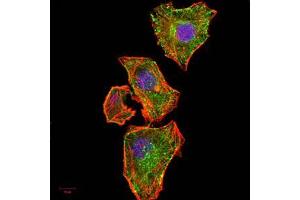 Immunofluorescence analysis of MCF-7 cells using NFKBIA mouse mAb (green).