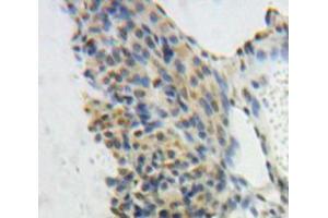 Used in DAB staining on fromalin fixed paraffin-embedded Ovary tissue (GTF2E1 anticorps  (AA 15-306))