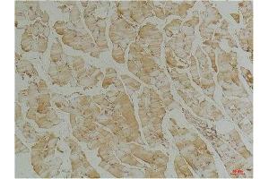 Immunohistochemical analysis of paraffin-embedded Mouse Skeletal Muscle Tissue using Desmin(mAb diluted at 1:200.