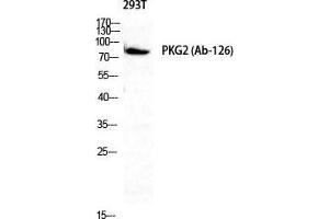 Western Blot (WB) analysis of 293T cells using cGKII Polyclonal Antibody. (PRKG2 anticorps  (Ser363, Thr359))