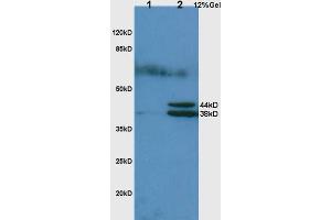 L1 rat lung lysates L2 rat liver lysates probed with Anti Hpt/Haptoglobin Polyclonal Antibody, Unconjugated (ABIN734738) at 1:200 in 4 °C. (Haptoglobin anticorps  (AA 251-350))