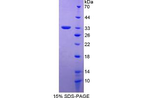 Image no. 1 for Amyloid beta (A4) Precursor Protein-Binding, Family A, Member 2 (APBA2) (AA 459-722) protein (His tag) (ABIN6237971)