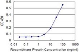Detection limit for recombinant GST tagged RPLP0 is 1 ng/ml as a capture antibody.