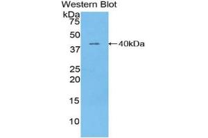 Western blot analysis of the recombinant protein. (TNNT1 anticorps  (AA 1-259))