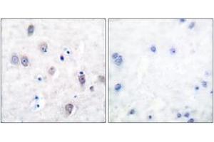 Immunohistochemistry analysis of paraffin-embedded human brain, using Amyloid beta A4 (Ab-743/668) Antibody. (APP anticorps  (AA 711-760))