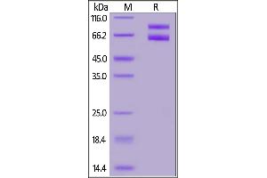 Human IL-2RB&IL-2RG Heterodimer Protein, Fc Tag&Fc Tag (MALS verified) on  under reducing (R) condition.