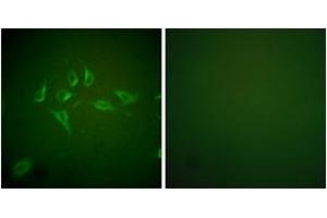 Immunofluorescence analysis of HepG2 cells, using iNOS Antibody. (NOS2 anticorps  (AA 1101-1150))