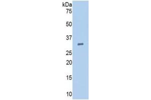 WB of Protein Standard: different control antibodies  against Highly purified E. (EGF Kit ELISA)