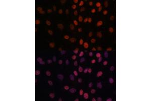 Immunofluorescence analysis of C6 cells using B antibody (ABIN7265702) at dilution of 1:100. (ARID1B anticorps  (AA 400-650))
