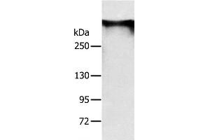 Western Blot analysis of Mouse brain tissue using RYR1 Polyclonal Antibody at dilution of 1:300 (RYR1 anticorps)